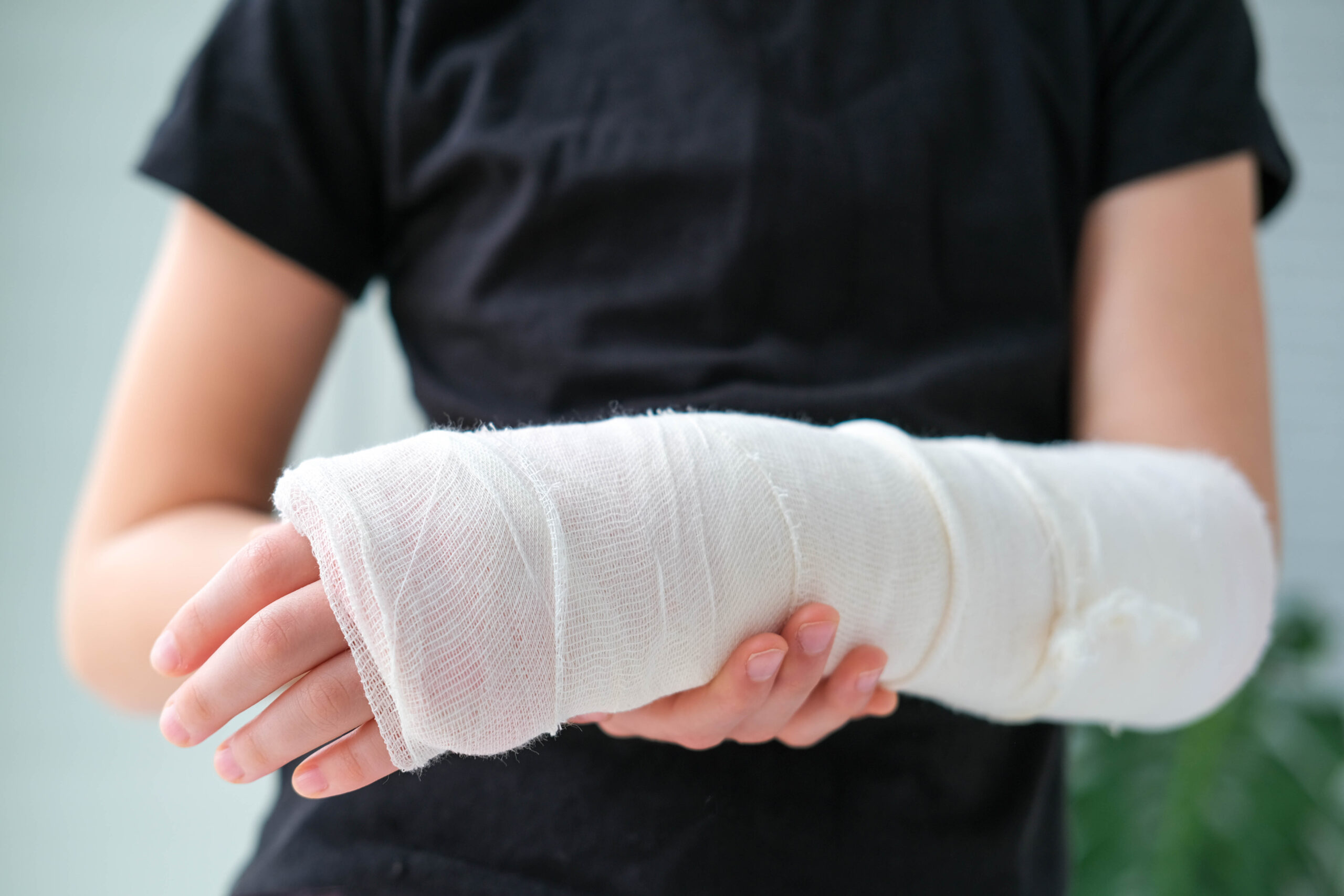 Pedestrian accident claims - victim with a broken arm in a cast