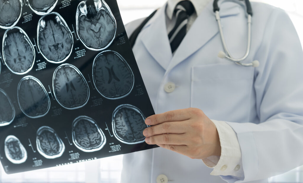 Brain injuries and brain damage