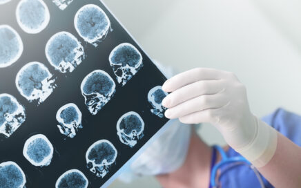 brain injury scans